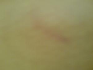 post-190453-1236688796_thumb.jpg