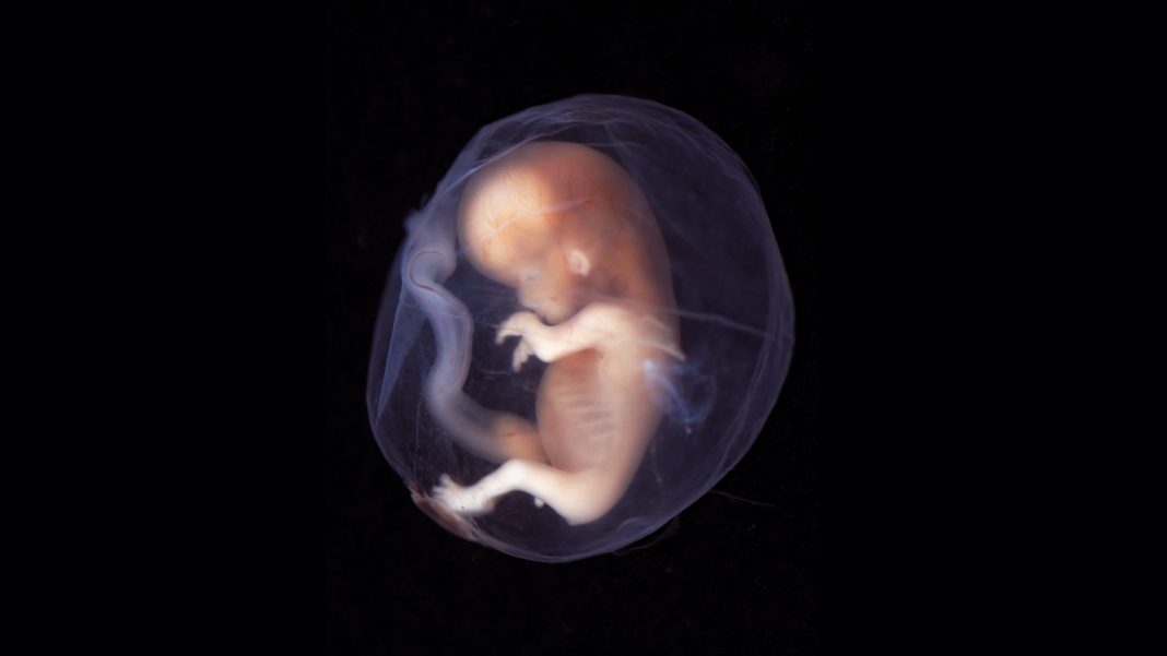 9-10-week-human-embryo-2048x1152 Учени в САЩ модифицираха с успех гените на ембрион