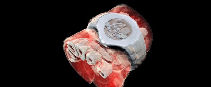 m1 Mars Bioimaging създаде първият в света цветен рентген