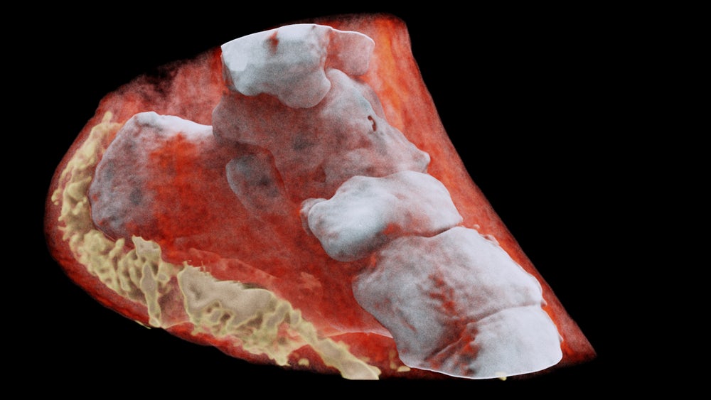 Mars Bioimaging създаде първият в света цветен рентген