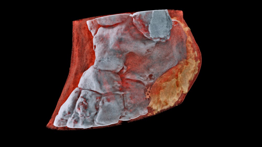 Mars Bioimaging създаде първият в света цветен рентген