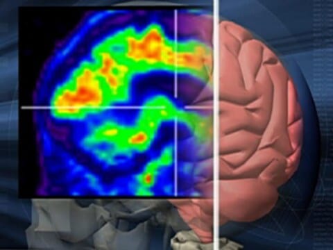 Хората с висок IQ по-бързо решават простичките задачи, но по-бавно се справят със сложните проблеми в сравнение с хората с по-нисък IQ