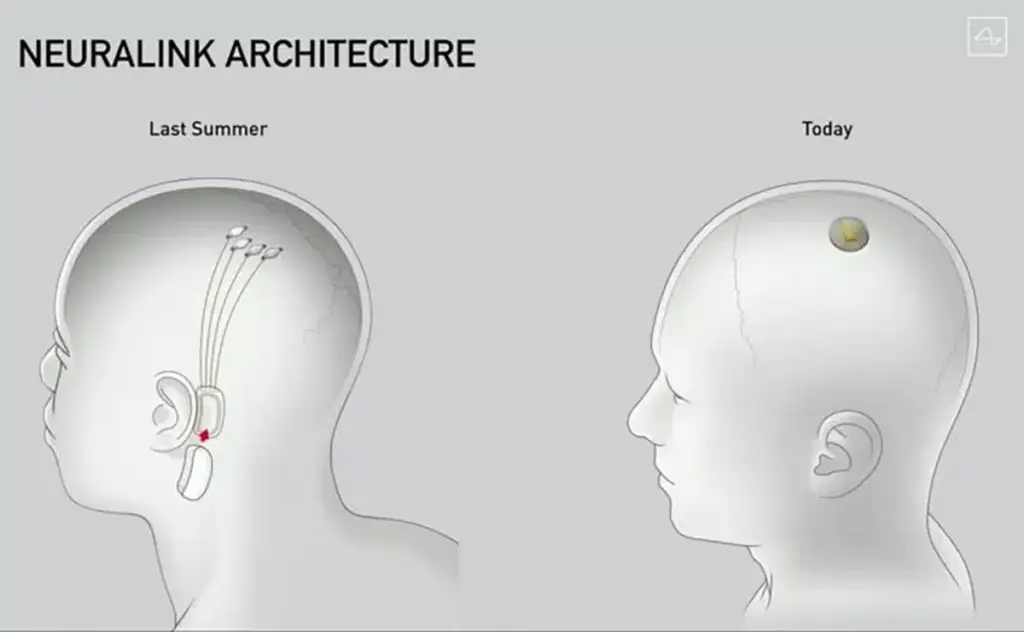 Neuralink на Илън Мъск има за цел да имплантира мозъчни чипове на 11 пациенти през 2024 година