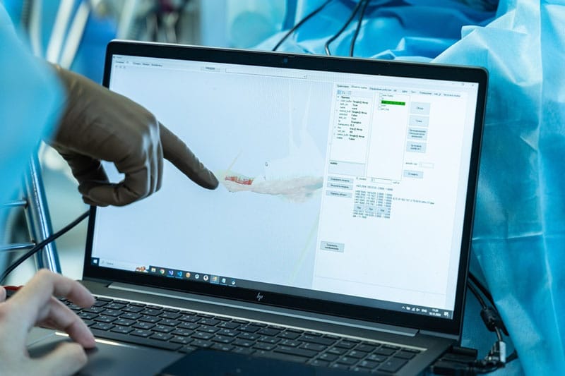 В Русия бе извършена първата в света операция с роботизиран биопринтер за отпечатване на мека тъкан директно върху раната на пациент