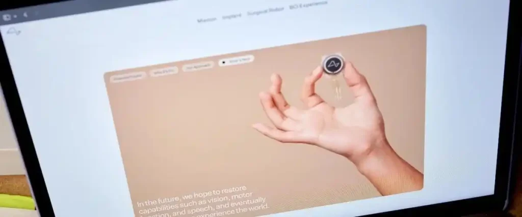 След една седмица Neuralink ще постави своя имплант на втори пациент