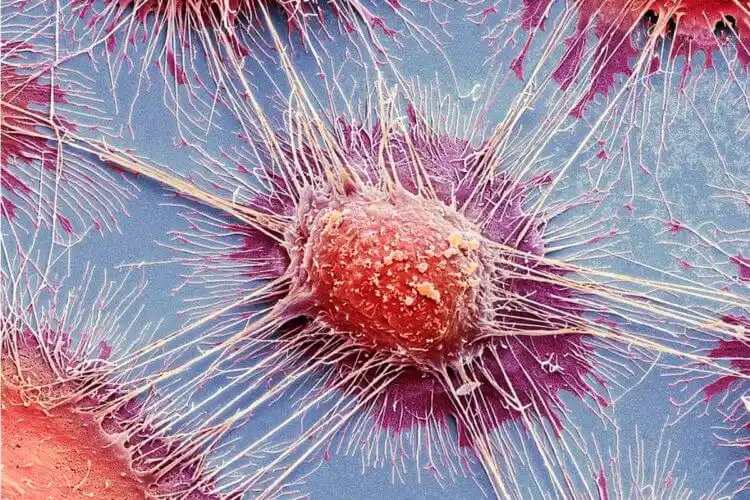 Защо хората се разболяват от рак? За всичко са виновни „зомби вирусите“