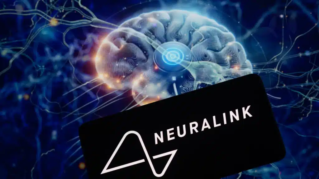 Първият пациент с Neuralink прекара една година с импланта в главата си – странични ефекти няма