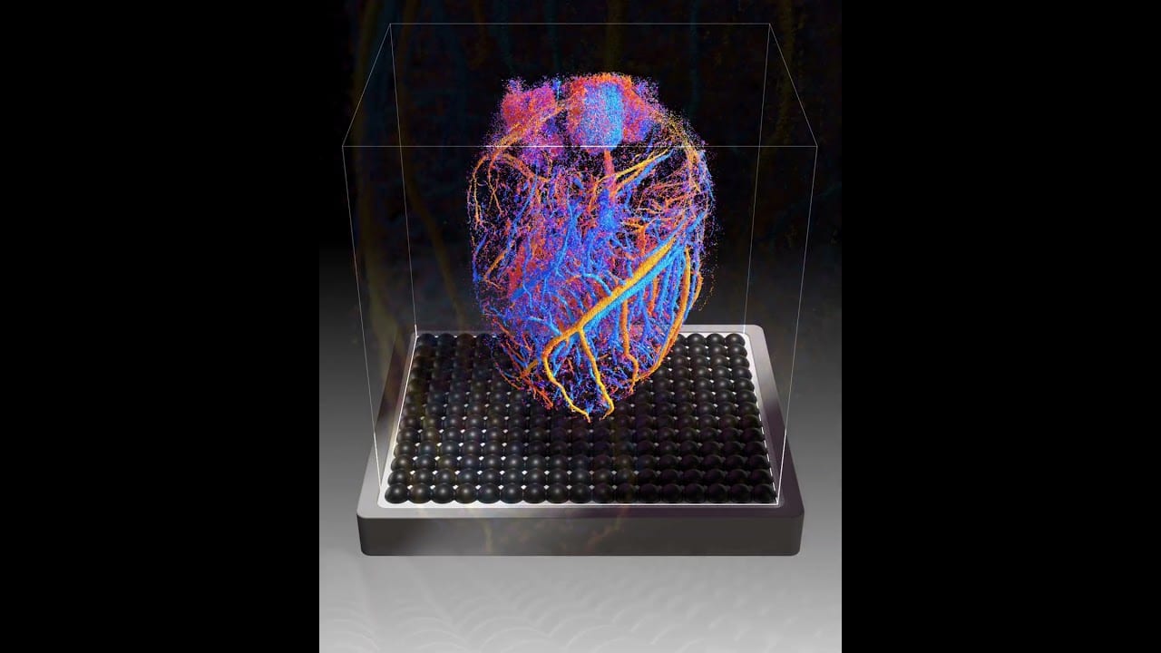 Четвъртото измерение е времето. Френски учени се научиха да изготвят 4D карти на кръвообращението в органите в реално време