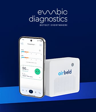 Александър Везенков инвестира в EMBIO Diagnostics и подкрепя новата система за следене на въздуха airbeld