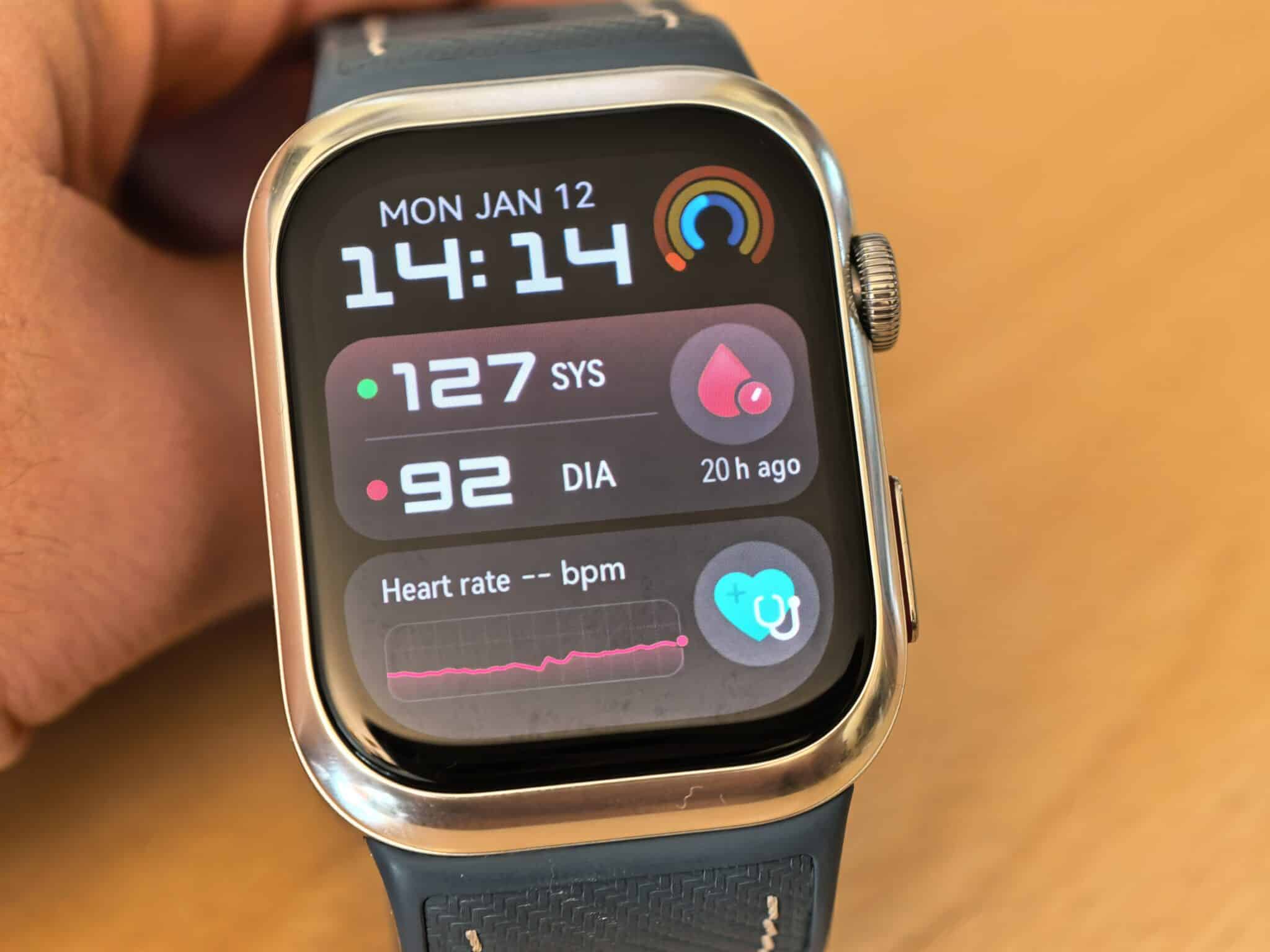 Huawei Watch D2 и истината за смартчасовниците с кръвно налягане