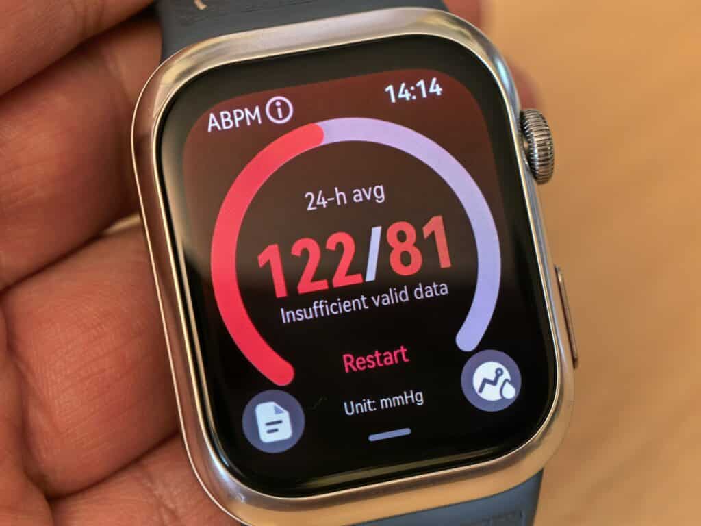 Huawei Watch D2 и истината за смартчасовниците с кръвно налягане