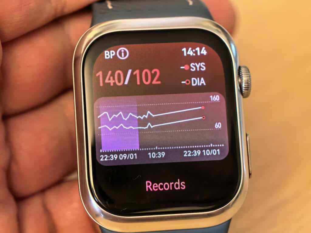 Huawei Watch D2 и истината за смартчасовниците с кръвно налягане