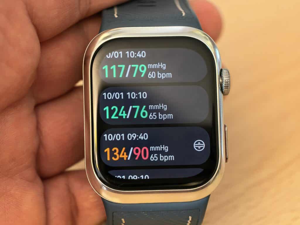 Huawei Watch D2 и истината за смартчасовниците с кръвно налягане