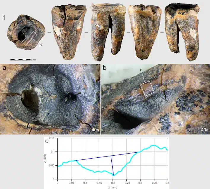 Първият зъболекар в историята е бил неандерталец: Откритие на 60 000 години пренаписва медицината