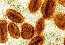 Двама учени са обвинени във внасянето на деактивиран вирус mpox в САЩ и лъжа към властите