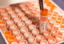 Пробив в медицината: Учени тестваха нова терапия със стволови клетки, която спира прогресията на Паркинсон