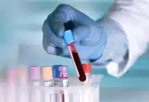 Лекарство, създадено с помощта на изкуствен интелект може да забави стареенето